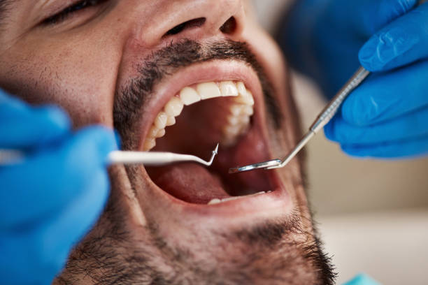 Best Chipped Tooth Repair Near Me  in Great Neck Gardens, NY