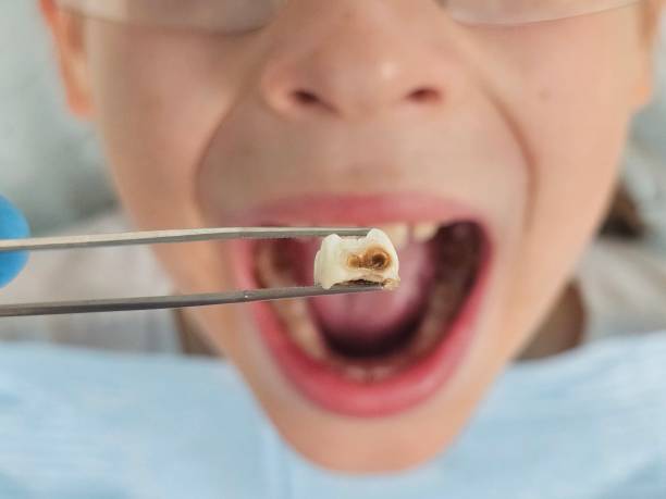 Best Emergency Tooth Extraction  in Great Neck Gardens, NY